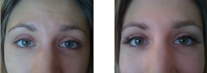 Eyelash extensions/ before & after photos. Client B